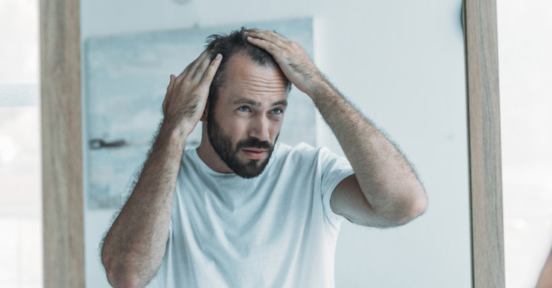 Wypadanie włosów u mężczyzn – rodzaje, przyczyny, leczenie