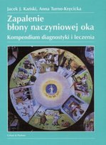 Zapalenie błony naczyniowej oka Opracowanie zbiorowe