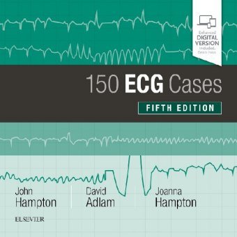 150 ECG Cases Adlam David