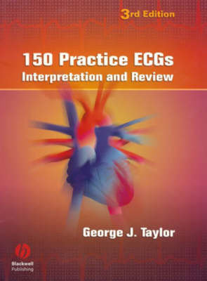 150 Practice Ecgs: Interpretation and Review Taylor George J.