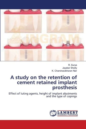 A study on the retention of cement retained implant prosthesis Surya R.