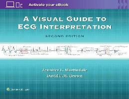 A Visual Guide to ECG Interpretation Martindale Jennifer L., Brown David F. M.