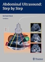 Abdominal Ultrasound: Step by Step Block Berthold