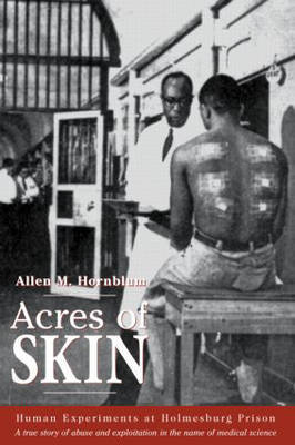 Acres of Skin Hornblum Allen M.