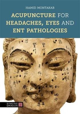 Acupuncture for Headaches, Eyes and ENT Pathologies Montakab Hamid