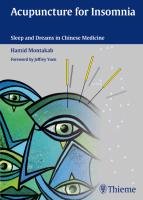Acupuncture for Insomnia Montakab Hamid