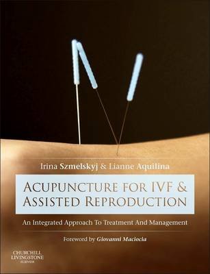 Acupuncture for IVF and Assisted Reproduction Szmelskyj Irina, Aquilina Lianne