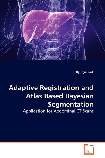 Adaptive Registration and Atlas Based Bayesian Segmentation Park Hyunjin