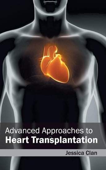 Advanced Approaches to Heart Transplantation ML Books International - IPS