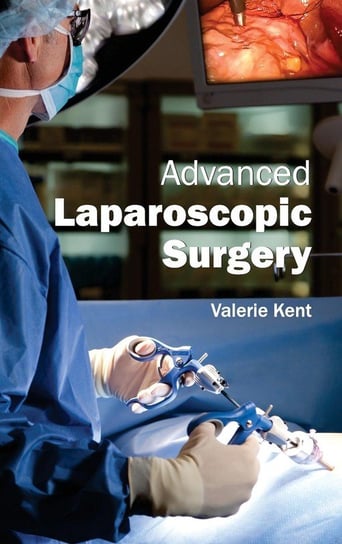 Advanced Laparoscopic Surgery M L Books International Pvt Ltd
