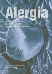 Alergia Holgate Stephen T., Church Martin K., Lichtenstein Lawrence M.
