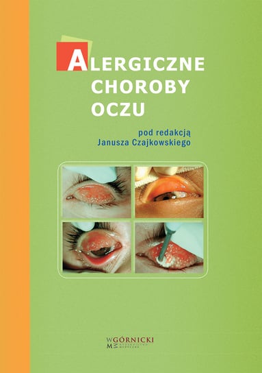 Alergiczne choroby oczu Bogacka Ewa, Czajkowski Janusz, Małolepszy Józef