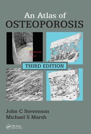 An Atlas of Osteoporosis John C. Stevenson, Michael S. Marsh