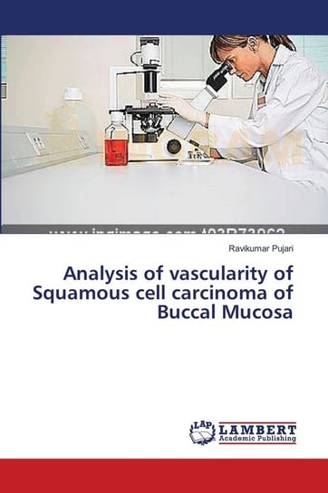 Analysis of vascularity of Squamous cell carcinoma of Buccal Mucosa Pujari Ravikumar