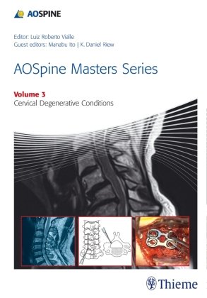 Aospine Masters Series Volume 3: Cervical Degenerative Conditions Thieme Medical Publ Inc., Thieme Medical Publishers