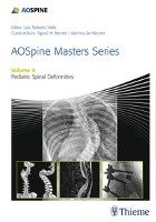 AOSpine Masters Series, Volume 9: Pediatric Spinal Deformities Thieme Georg Verlag, Thieme Medical Publishers Inc.