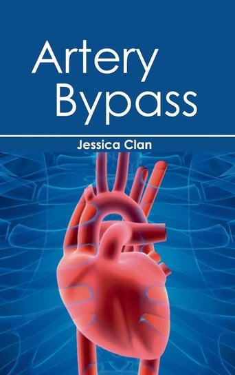 Artery Bypass ML Books International - IPS