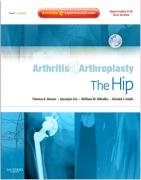 Arthritis and Arthroplasty: The Hip Brown Thomas E.
