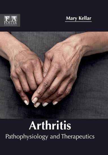 Arthritis Null