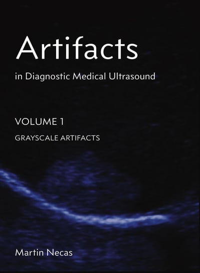 Artifacts in Diagnostic Medical Ultrasound - ebook epub Martin Necas