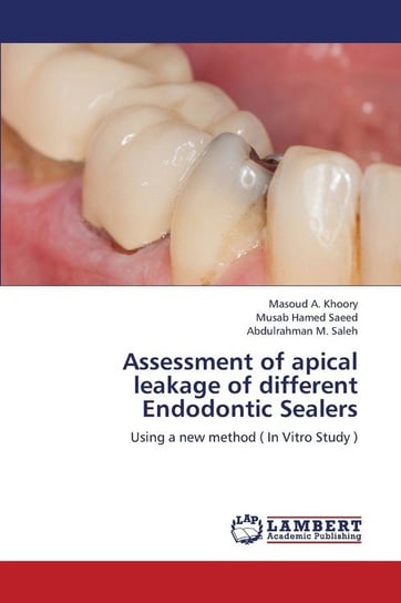 Assessment of Apical Leakage of Different Endodontic Sealers Khoory Masoud A.