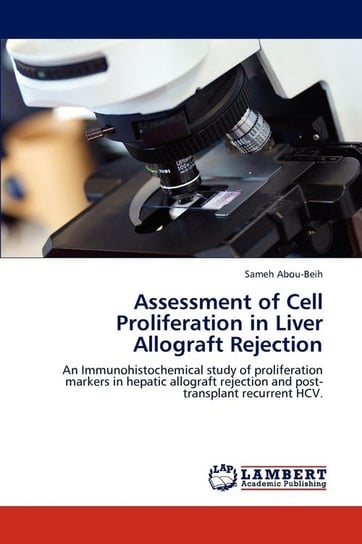 Assessment of Cell Proliferation in Liver Allograft Rejection Abou-Beih Sameh