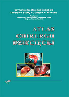Atlas chirurgii dziecięcej Opracowanie zbiorowe
