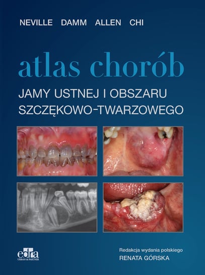 Atlas chorób jamy ustnej i obszaru szczękowo-twarzowego Damm N., Chi A.