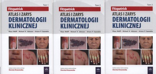 Atlas i zarys dermatologii Fitzpatricka. Tom 1-3 Wolff Klaus, Johnson Richard A., Saavedra Arturo P.