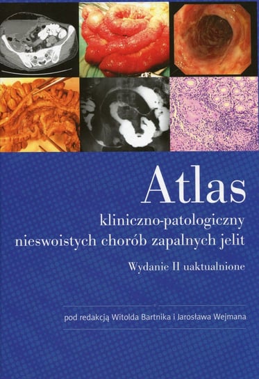 Atlas kliniczno-patologiczny nieswoistych chorób zapalnych jelit Opracowanie zbiorowe