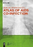 Atlas of AIDS Co-infection Gruyter Walter Gmbh, Gruyter