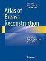 Atlas of Breast Reconstruction Rietjens Mario, Casales Schorr Mario