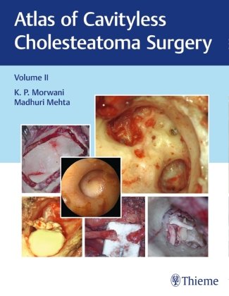 Atlas of Cavityless Cholesteatoma Surgery, Vol 2. Vol.2 Thieme, Stuttgart