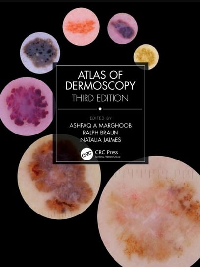 Atlas of Dermoscopy: Third Edition Opracowanie zbiorowe