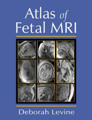 Atlas of Fetal MRI Opracowanie zbiorowe