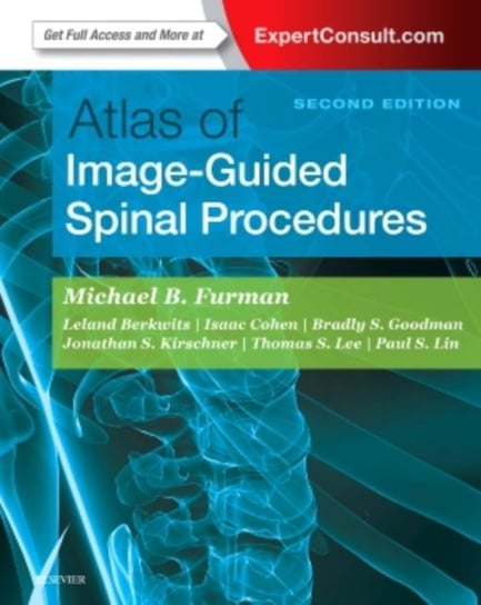 Atlas of Image-Guided Spinal Procedures Furman Michael