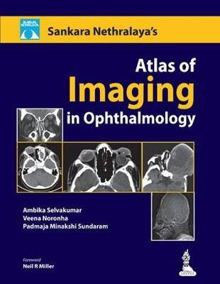 Atlas of Imaging in Ophthalmology S Ambika