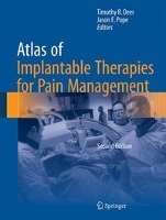 Atlas of Implantable Therapies for Pain Management Deer Timothy R., Pope Jason E.