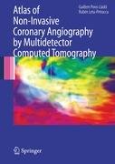 Atlas of Non Invasive Coronary Angiography by Multidetector Computed Tomography Pons-Llado Guillem, Leta-Petracca Ruben