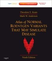 Atlas of Normal Roentgen Variants That May Simulate Disease Keats Theodore E., Anderson Mark W.