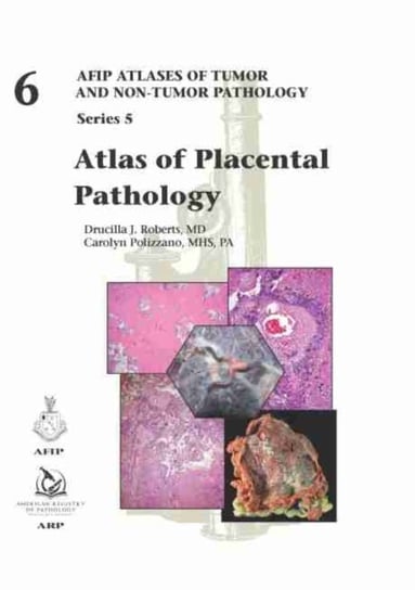 Atlas of Placental Pathology Drucilla J. Roberts, Carolyn Polizzano