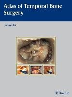 Atlas of Temporal Bone Surgery Ulug Tuncay