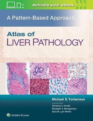 Atlas of the Liver and Pancreas Pathology: A Pattern Based Approach Torbenson Michael