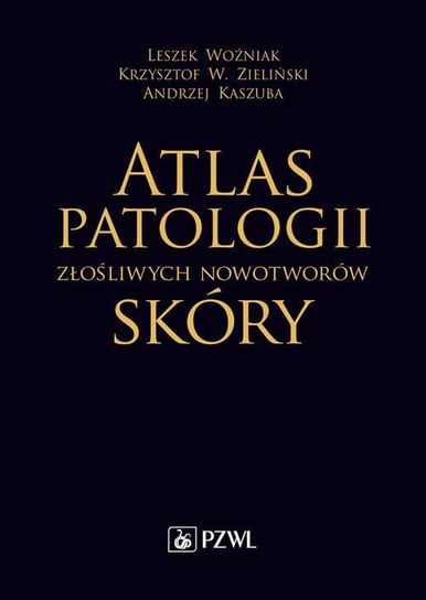 Atlas patologii złośliwych nowotworów skóry Woźniak Leszek, Zieliński Krzysztof, Kaszuba Andrzej