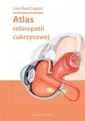 Atlas retinopatii cukrzycowej DK Media Poland