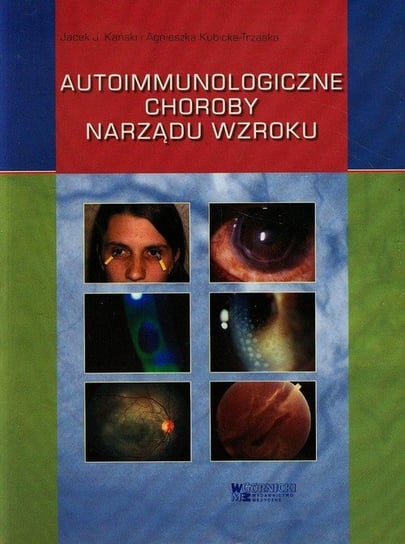 Autoimmunologiczne choroby narządu wzroku Kański Jacek J., Kubicka-Trząska Agnieszka