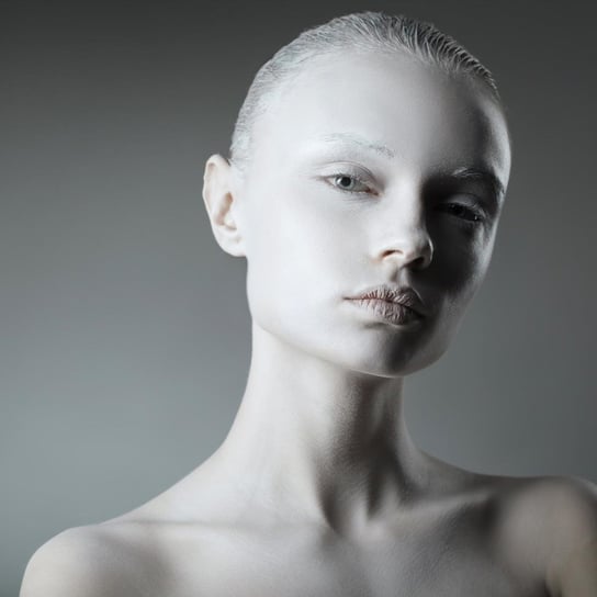 Bielactwo i albinizm to nie tylko defekty skóry. - Radioklinika - podcast Opracowanie zbiorowe