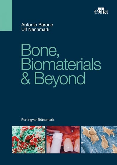 Bone, Biomaterials & Beyond Antonio Barone, Ulf Nannmark