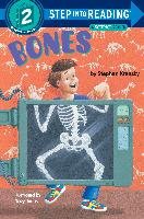 Bones Krensky Stephen