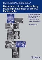 Borderlands of Normal and Early Pathologic Findings in Skeletal Radiograph Kohler, Zimmer